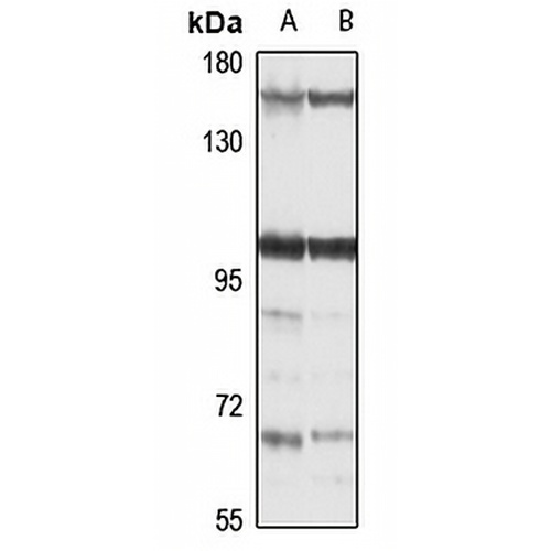 RBM10 Rabbit Polyclonal Antibody