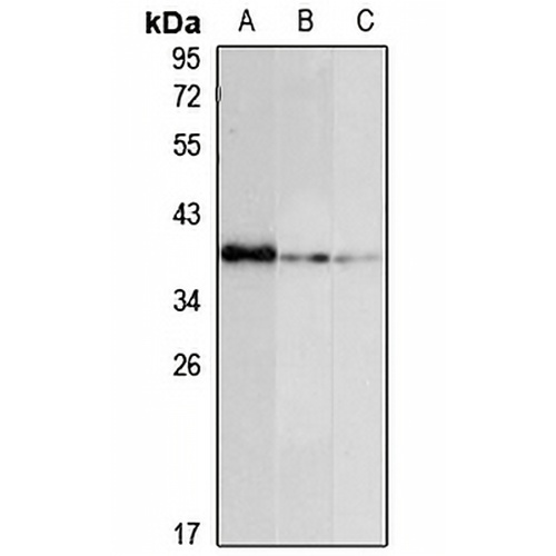 RBM11 Rabbit Polyclonal Antibody