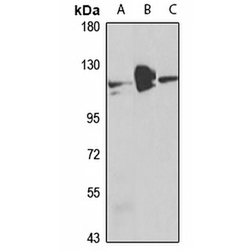 RBM15 Rabbit Polyclonal Antibody