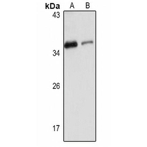 RBM7 Rabbit Polyclonal Antibody