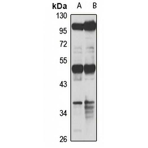RBMS1 Rabbit Polyclonal Antibody