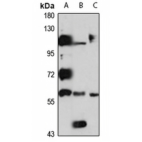 RCBTB2 Rabbit Polyclonal Antibody
