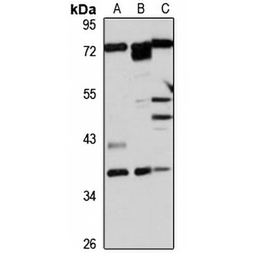 RDH10 Rabbit Polyclonal Antibody
