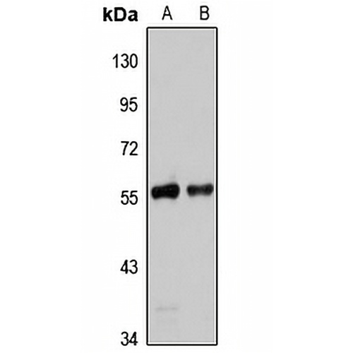 REXO4 Rabbit Polyclonal Antibody