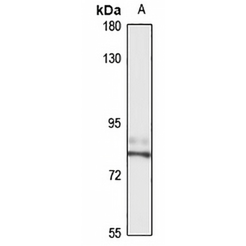 RFX2 Rabbit Polyclonal Antibody