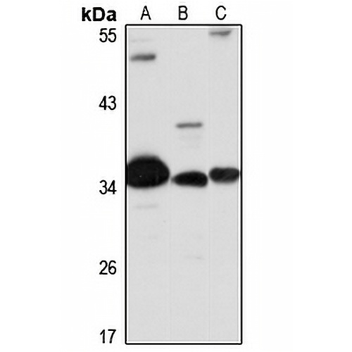 RHBDD1 Rabbit Polyclonal Antibody