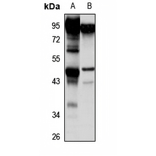 RHBDL1 Rabbit Polyclonal Antibody