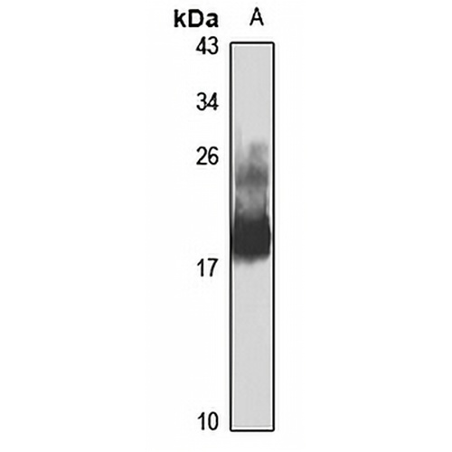 RhoB Rabbit Polyclonal Antibody