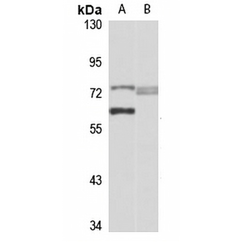 RHOBTB1 Rabbit Polyclonal Antibody