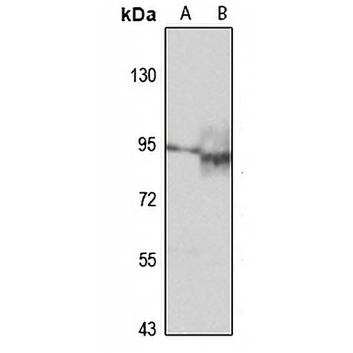 RIPK4 Rabbit Polyclonal Antibody