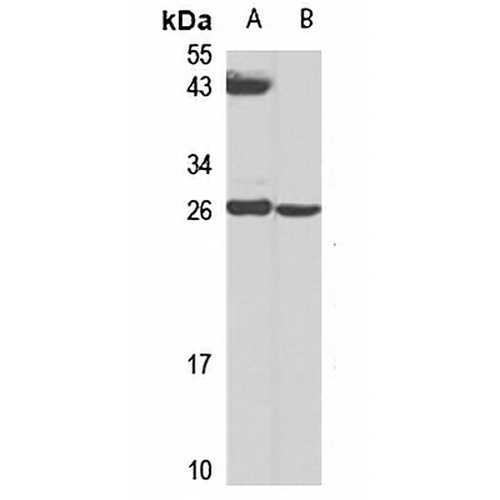 RNase 2 Rabbit Polyclonal Antibody