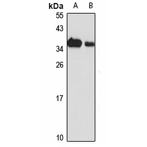 RNase H1 Rabbit Polyclonal Antibody