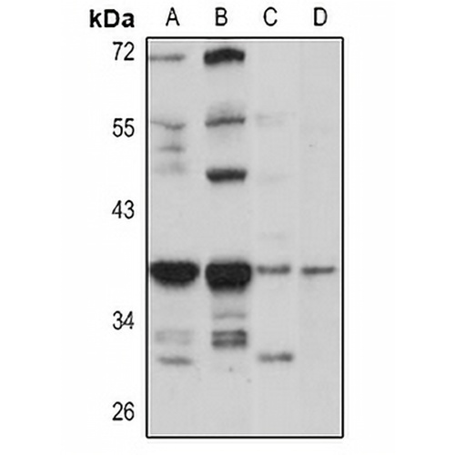 RNase H2B Rabbit Polyclonal Antibody