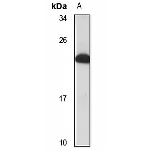 RNF152 Rabbit Polyclonal Antibody