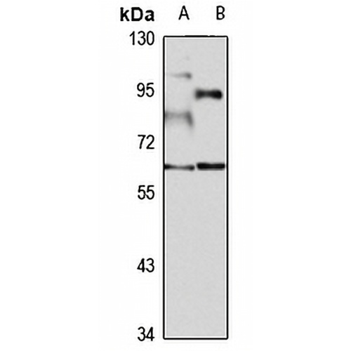 RNF168 Rabbit Polyclonal Antibody