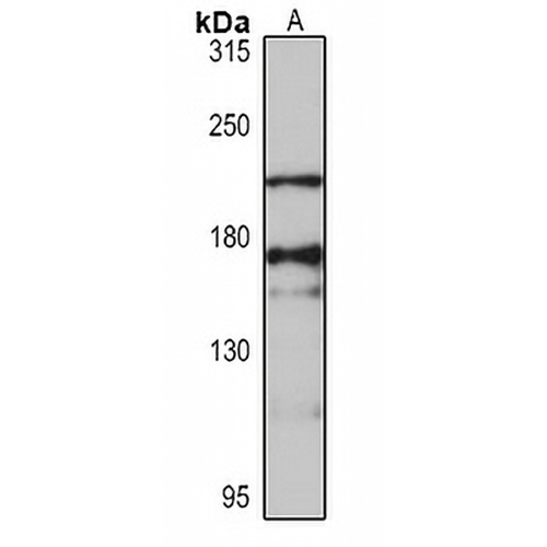 RNF17 Rabbit Polyclonal Antibody