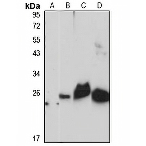 RNF181 Rabbit Polyclonal Antibody