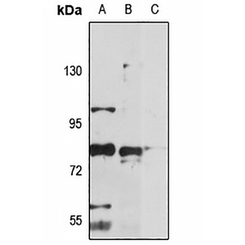 RNF6 Rabbit Polyclonal Antibody