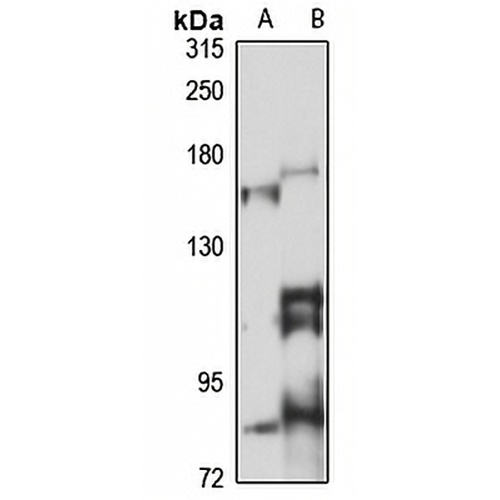 ROBO3 Rabbit Polyclonal Antibody