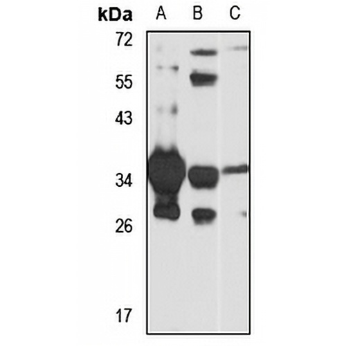 BXDC1 Rabbit Polyclonal Antibody