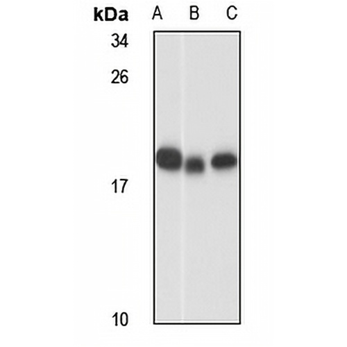 RPL18A Rabbit Polyclonal Antibody