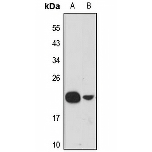 Ribosomal Protein L21 Rabbit Polyclonal Antibody
