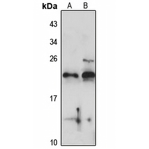 RPL24 Rabbit Polyclonal Antibody