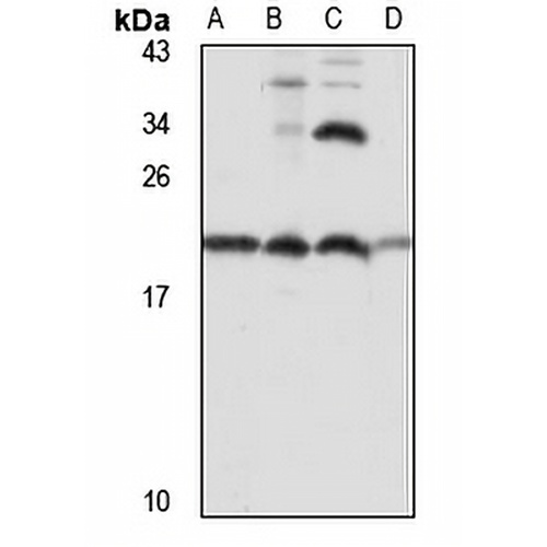 Ribosomal Protein L26 Rabbit Polyclonal Antibody