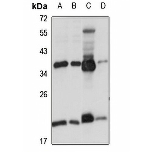 Ribosomal Protein L6 Rabbit Polyclonal Antibody