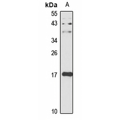 RPP25L Rabbit Polyclonal Antibody