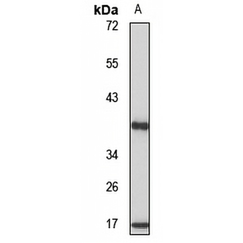 RPP38 Rabbit Polyclonal Antibody