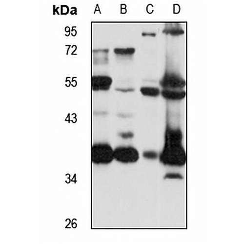 RPRD1A Rabbit Polyclonal Antibody