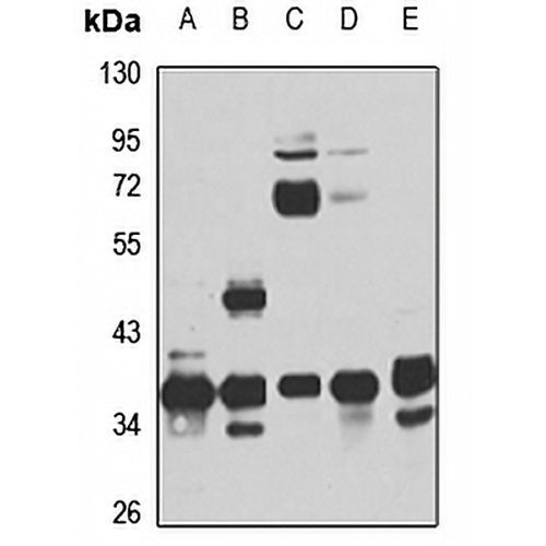 RPRD1B Rabbit Polyclonal Antibody