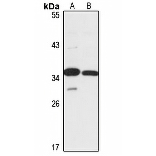 RRP36 Rabbit Polyclonal Antibody