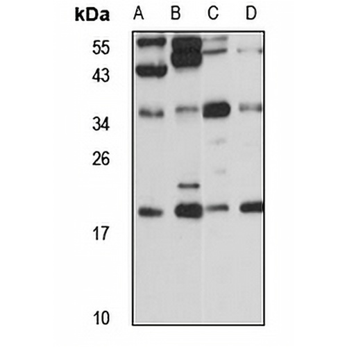 RSPH9 Rabbit Polyclonal Antibody