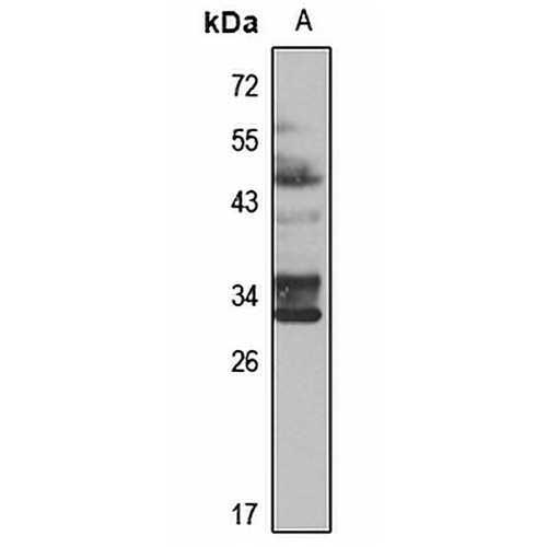 RSPO1 Rabbit Polyclonal Antibody