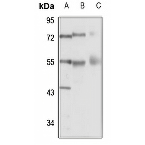 RTCB Rabbit Polyclonal Antibody