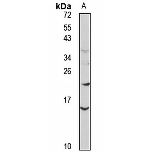 SAA Rabbit Polyclonal Antibody