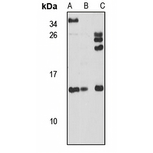 SAA4 Rabbit Polyclonal Antibody