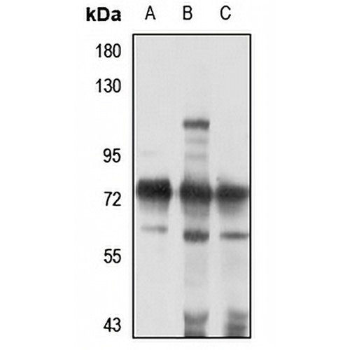 SALL4 Rabbit Polyclonal Antibody