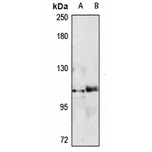 SALL4 Rabbit Polyclonal Antibody