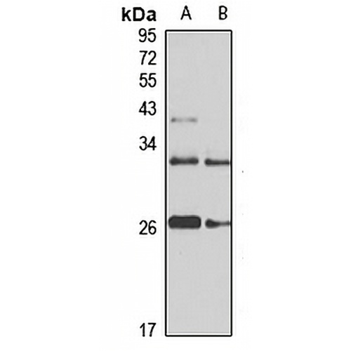 SAR1A Rabbit Polyclonal Antibody