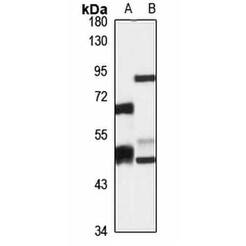 SerRSmt Rabbit Polyclonal Antibody