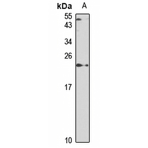 SAT1 Rabbit Polyclonal Antibody