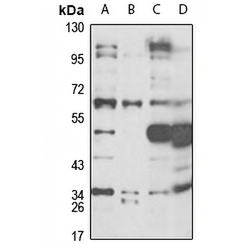 CD36 Rabbit Polyclonal Antibody