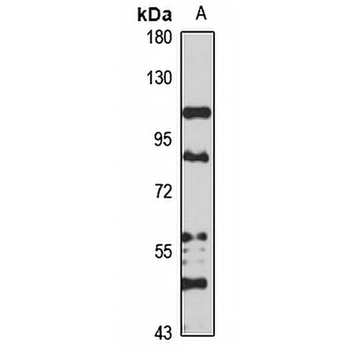 Adseverin Rabbit Polyclonal Antibody