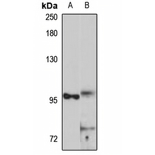 SCYL2 Rabbit Polyclonal Antibody
