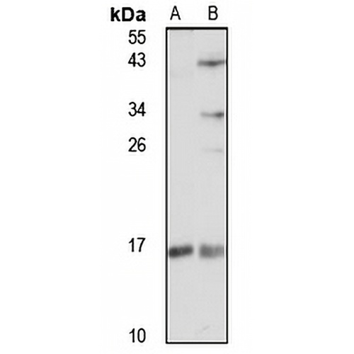 SDHAF2 Rabbit Polyclonal Antibody