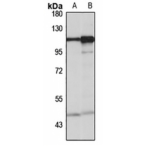 SEC24C Rabbit Polyclonal Antibody