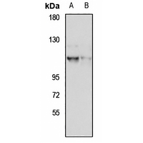 SEC24D Rabbit Polyclonal Antibody